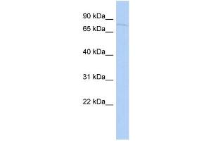 WB Suggested Anti-SFRS12 Antibody Titration: 0.