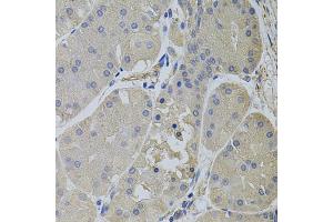 Immunohistochemistry of paraffin-embedded human stomach using CLTC antibody (ABIN5995396) (40x lens).