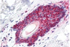 Human Skin, Hair Follicle (formalin-fixed, paraffin-embedded) stained with CTNNB1 antibody ABIN337082 at 2.