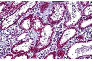 Human Kidney: Formalin-Fixed, Paraffin-Embedded (FFPE) (Retinol Binding Protein 5 antibody  (AA 10-59))