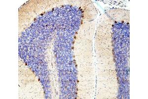 IHC analysis of SMAD2 using anti-SMAD2 antibody (ABIN6719361). (SMAD2 antibody  (AA 83-264))