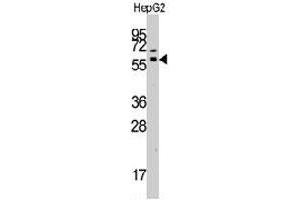 Western blot analysis of GRK7 polyclonal antibody  in HepG2 cell line lysates (35 ug/lane).