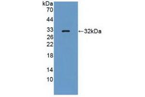 Detection of Recombinant PTPRQ, Human using Polyclonal Antibody to Protein Tyrosine Phosphatase Receptor Type Q (PTPRQ) (PTPRQ antibody  (AA 36-294))