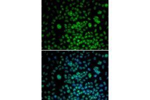 Immunofluorescence analysis of U2OS cells using MAX antibody (ABIN5971184). (MAX antibody)
