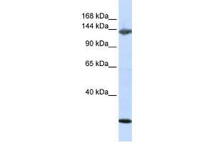 Western Blotting (WB) image for anti-Jagged 2 (JAG2) antibody (ABIN2458924)