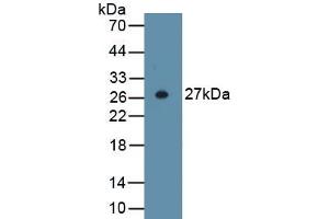 Detection of Recombinant ACTa2, Human using Anti-Actin Alpha 2, Smooth Muscle (ACTa2) Polyclonal Antibody (Smooth Muscle Actin antibody  (AA 167-377))