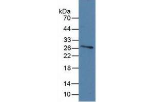 WB of Protein Standard: different control antibodies  against Highly purified E. (Vitamin D-Binding Protein ELISA Kit)