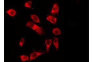 ABIN6278603 staining HeLa by IF/ICC. (OR1D4/5 antibody)
