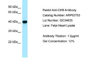 Western Blotting (WB) image for anti-Creatine Kinase, Brain (CKB) (C-Term) antibody (ABIN2789613) (CKB antibody  (C-Term))