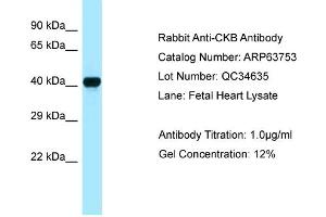 Western Blotting (WB) image for anti-Creatine Kinase, Brain (CKB) (C-Term) antibody (ABIN970402) (CKB antibody  (C-Term))