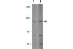 Western blot analysis of AP3B2 in rat brain tissue lysate with AP3B2 polyclonal antibody  at (1) 1 and (2) 2 ug/mL. (AP3B2 antibody  (N-Term))