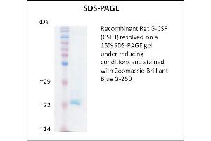 SDS-PAGE (SDS) image for Colony Stimulating Factor 3 (Granulocyte) (CSF3) (Active) protein (ABIN5509805)