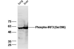 IRF3 antibody  (pSer396)