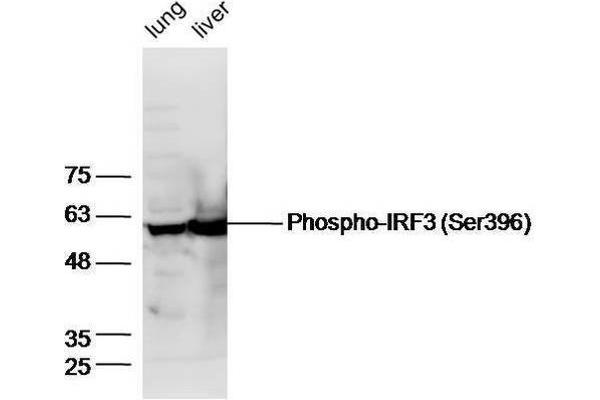 IRF3 antibody  (pSer396)