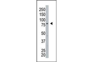 Image no. 1 for anti-Glycosylphosphatidylinositol Specific phospholipase D1 (GPLD1) (C-Term) antibody (ABIN357724) (GPLD1 antibody  (C-Term))