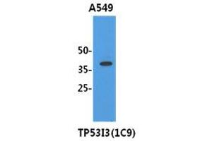 Image no. 1 for anti-Tumor Protein P53 Inducible Protein 3 (TP53I3) (AA 1-332), (N-Term) antibody (ABIN1109286) (TP53I3 antibody  (N-Term))