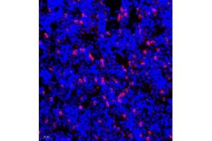 Immunofluorescence of paraffin embedded mouse bone using CSF1 (ABIN7073553) at dilution of 1:900 (400x lens) (M-CSF/CSF1 antibody)
