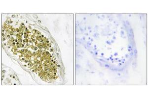 Immunohistochemistry analysis of paraffin-embedded human testis tissue using HIPK4 antibody. (HIPK4 antibody  (C-Term))