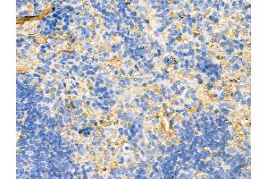 ABIN7094520 and ABIN7098569 at 1/100 staining Rat spleen tissue by IHC-P. (HTR7 antibody  (N-Term))