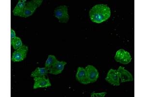 Immunofluorescence staining of Hela cells with ABIN7167457 at 1:166, counter-stained with DAPI. (GNB2L1 antibody  (AA 93-317))