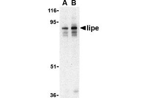 Western Blotting (WB) image for anti-Lipase, Hormone-Sensitive (LIPE) (C-Term) antibody (ABIN1030485) (LIPE antibody  (C-Term))