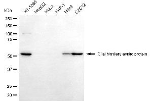 Western blotting analysis using glial fibrillary acidic protein antibody (ABIN7798723).