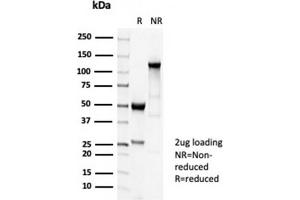 SDS-PAGE Analysis Purified TUBB3 Recombinant Rabbit Monoclonal Antibody (TUBB3/7089R). (Recombinant TUBB3 antibody  (AA 437-450))