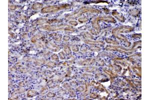 IHC analysis of NOV/CCN3 using anti-NOV/CCN3 antibody .