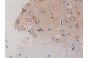 Used in DAB staining on fromalin fixed paraffin- embedded lung tissue (Hsc70 antibody  (AA 534-615))