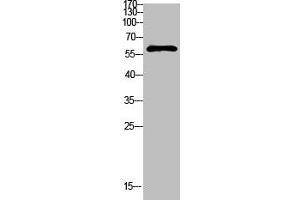 Western Blot analysis of mouse-kidney cells using Antibody diluted at 1000 (FBXO7 antibody  (AA 371-420))
