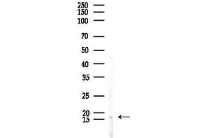 Western blot analysis of lysates from Rat brain, using ME Antibody at 1/1000 dilution.
