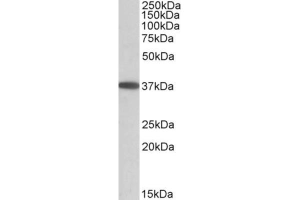 MOGAT2 anticorps  (Internal Region)