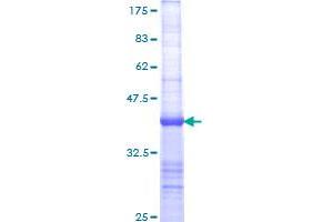 Image no. 1 for NLR Family, Apoptosis Inhibitory Protein (NAIP) (AA 1294-1403) protein (GST tag) (ABIN1311946) (NAIP Protein (AA 1294-1403) (GST tag))