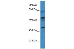 Western Blot showing CRLF1 antibody used at a concentration of 1. (CRLF1 antibody  (Middle Region))