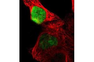 Immunofluorescent staining of A-431 cells with OVOL1 polyclonal antibody  (Green) shows positivity in nucleus.