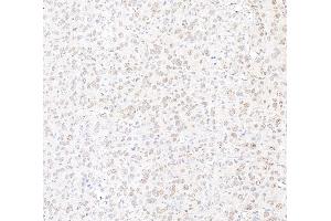 Immunohistochemistry (IHC) image for anti-Mediator Complex Subunit 12 (MED12) (C-Term) antibody (ABIN7453548) (MED12 antibody  (C-Term))