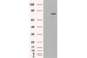 Western Blotting (WB) image for anti-phosphodiesterase 4B, cAMP-Specific (PDE4B) (C-Term) antibody (ABIN2466109)