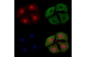ABIN6255069 and ABIN6267579 staining Hela cells(4h of LPS treatment) by IF/ICC. (FOXO4 antibody  (pSer197))