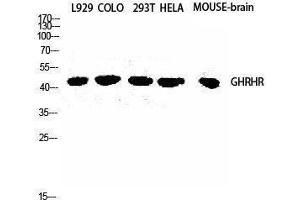 GHRHR antibody  (C-Term)