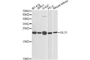 Western blot analysis of extracts of various cell lines, using GLO1 antibody (ABIN1872829) at 1:1000 dilution. (GLO1 antibody)