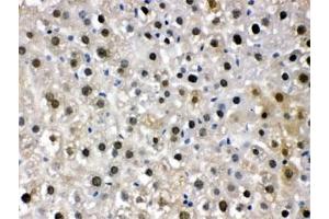 IHC testing of FFPE mouse liver with DDB1 antibody. (DDB1 antibody  (AA 1011-1140))