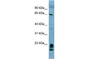 WB Suggested Anti-FAM134A  Antibody Titration: 0.