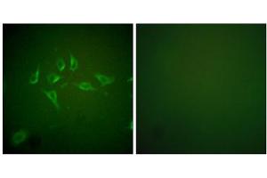 Immunofluorescence analysis of HepG2 cells, using NOS2 antibody (ABIN5976446).