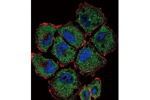 Confocal immunofluorescent analysis of SLC36A1 Antibody (N-term) (ABIN656104 and ABIN2845446) with NCI- cell followed by Alexa Fluor 488-conjugated goat anti-rabbit lgG (green). (SLC36A1 antibody  (N-Term))