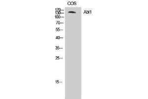 Western Blotting (WB) image for anti-C-Abl Oncogene 1, Non-Receptor tyrosine Kinase (ABL1) (Ser120), (Ser121) antibody (ABIN3183605)