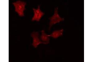 ABIN6275787 staining HepG2 cells by IF/ICC. (SRCIN1 antibody  (Internal Region))