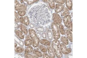 Immunohistochemical staining of human kidney with EEFSEC polyclonal antibody  shows moderate cytoplasmic and nuclear positivity in cells in tubules at 1:50-1:200 dilution. (EEFSEC antibody)