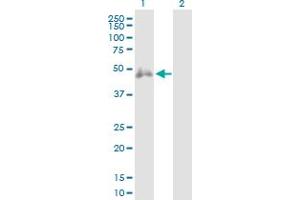 Western Blot analysis of CD2 expression in transfected 293T cell line by CD2 MaxPab polyclonal antibody. (CD2 antibody  (AA 1-351))