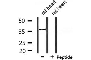 Western blot analysis of extracts from rat heart, using CACNG7 Antibody.