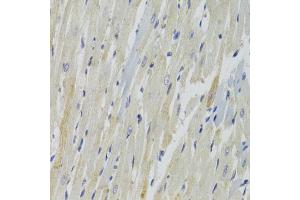 Immunohistochemistry of paraffin-embedded rat heart using AKT1S1 Antibody (ABIN1882365) at dilution of 1:100 (40x lens).